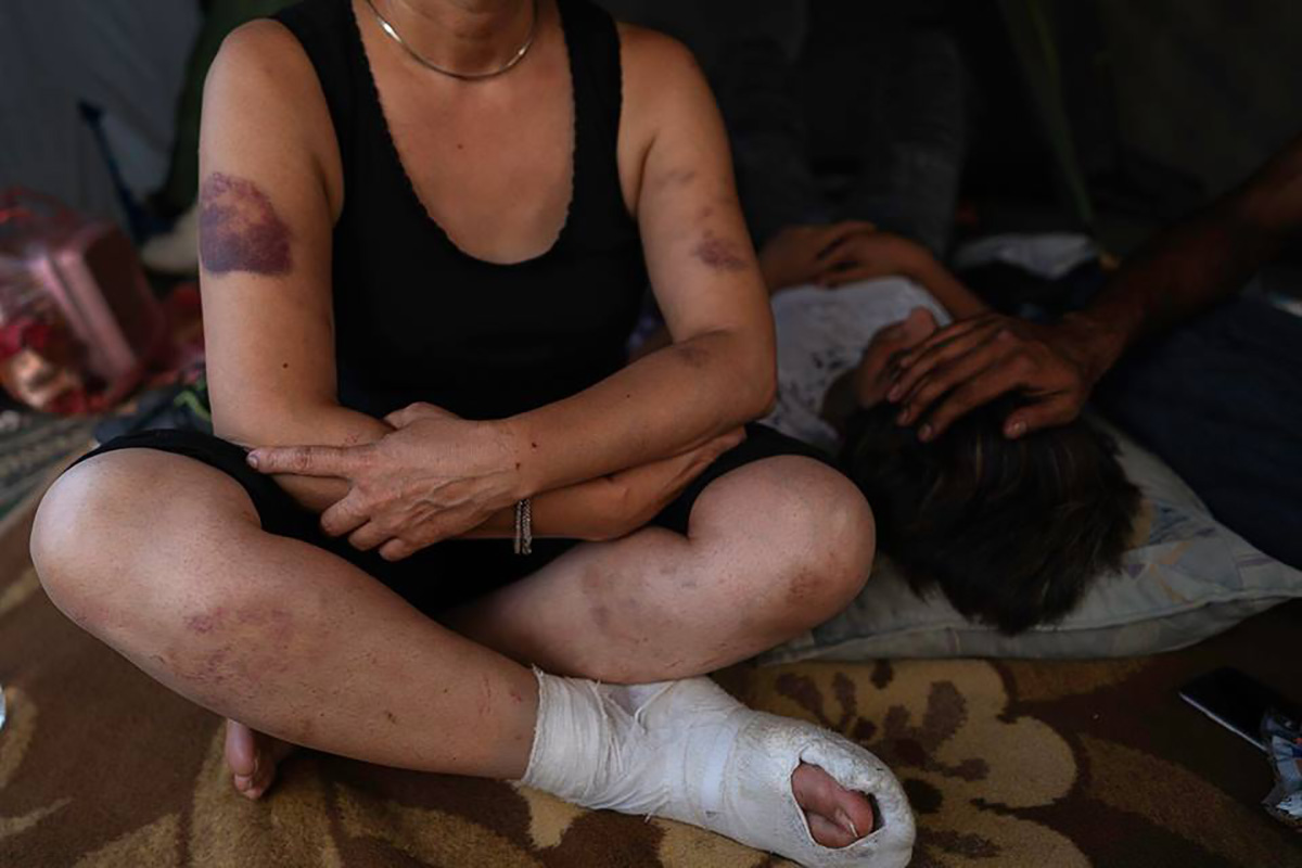 Eram, 47, returned to the camp in the northwestern Bosnian town of Velika Kladusa after attempting to cross the Croatian border (Photo: No Name Kitchen).