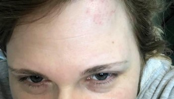 Investigative Journalist, Lawyer Attacked in Grozny