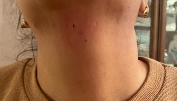 Azeri Journalist Threatened With Knife for Covering Controversial Trial