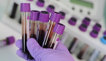 Blood Plasma Black Market Emerges in Pakistan Amid COVID-19 Crisis 