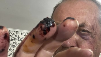 В Комитете защиты журналистов встревожены нападениями на журналистов в Украине