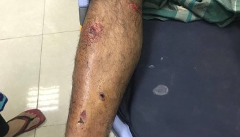 Brother of Investigative Journalist Beaten in Bangladesh over Articles about Graft