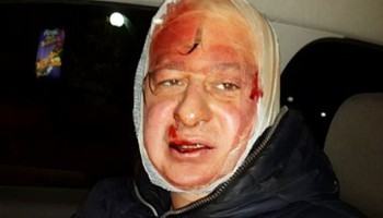 Ukraine: Dozens of Journalists Assaulted by Police at Protest