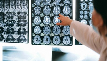 Athira Pharma to Pay $4 Million in Settlement Over Research Misconduct Allegations