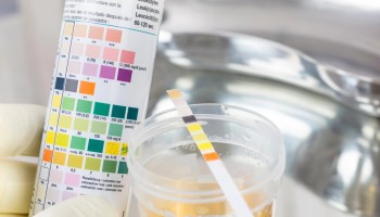 U.S. Toxicology Lab to Pay $27M to Settle Kickback Allegations
